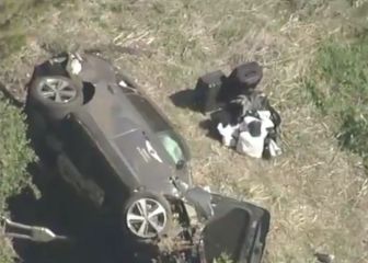 Tiger Woods hospitalised after car crash