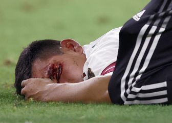 Lozano suffers serious injury in Mexico draw with Soca Warriors