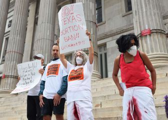 How will Texas' new abortion law impact access and the cost of an abortion?