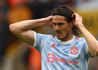 United star Cavani struggling to shake off tendon injury
