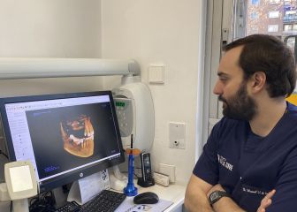 Millions on Medicaid struggle to access dental care