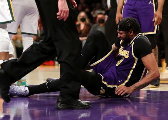 Anthony Davis likely out two weeks
