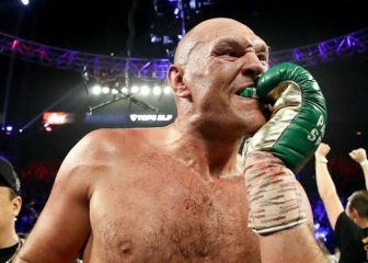 Tyson Fury vs Dillian Whyte is now officially on