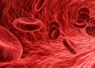 New tool in fight against unhealthy cholesterol