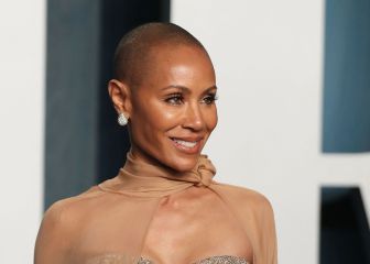What is alopecia and why was Chris Rock joking about it with Jada Smith?