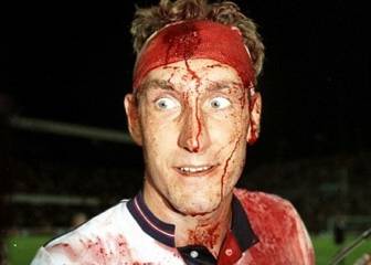 Terry Butcher, en su inmortal foto ensangrentado
