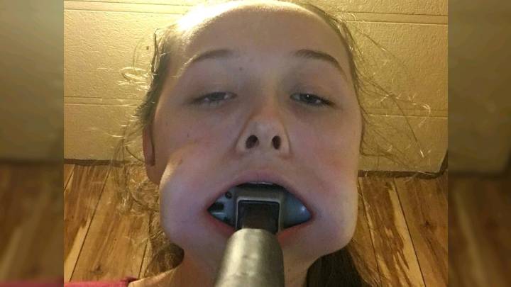 Pide ayuda en Twitter después de meterse un martillo en la boca