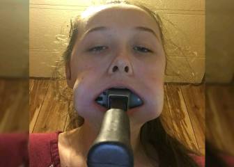 Pide ayuda en Twitter después de meterse un martillo en la boca y no poder sacárselo