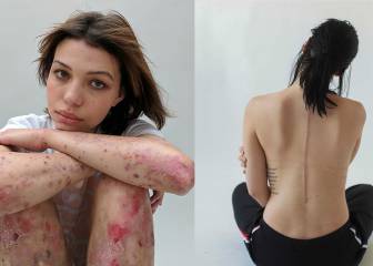 Esta fotógrafa te demuestra que las cicatrices también pueden ser arte