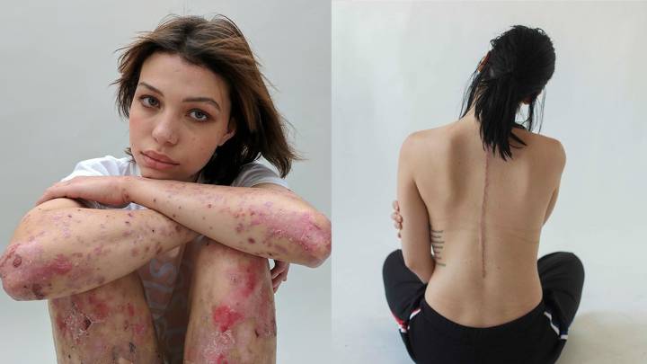 Esta fotógrafa te demuestra que las cicatrices también pueden ser arte