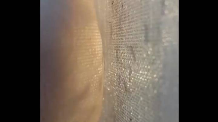 Este impactante vídeo te hará entender por qué nos pican los mosquitos