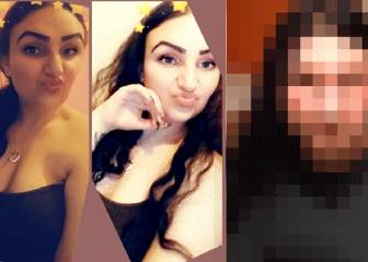 Una mujer termina desfigurada tras teñirse el pelo