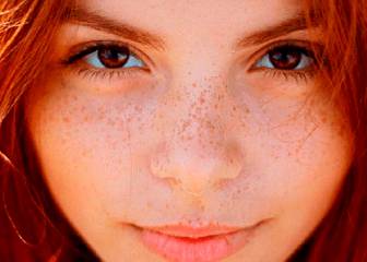 Se tatúa en forma de pecas y el resultado la deja horrorizada