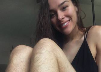 Mujer publica su experiencia sin depilarse y es atacada en redes