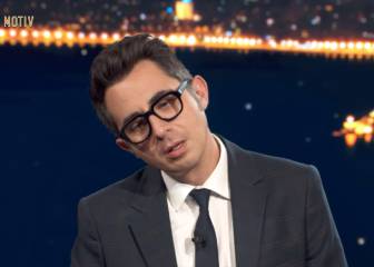 Esta es la cara de Berto al explicar por qué besamos con los ojos cerrados