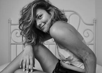 Un fotógrafo reta a la industria mostrando las imperfecciones de sus modelos