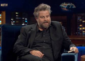 El análisis de Raúl Cimas sobre el pelo que no gustará a los pelirrojos