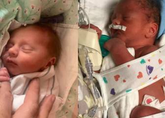 Estos gemelos nacen en días, años y décadas diferentes