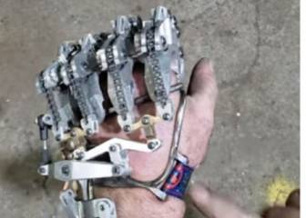 Este hombre ha conseguido construirse una mano mecánica tras perder 9 dedos