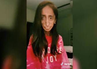 Lizzie Velasquez pide que dejen de usar su cara para bromas en TikTok