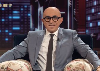 ¿Por qué Berto ha aparecido calvo en 'Late Motiv'?