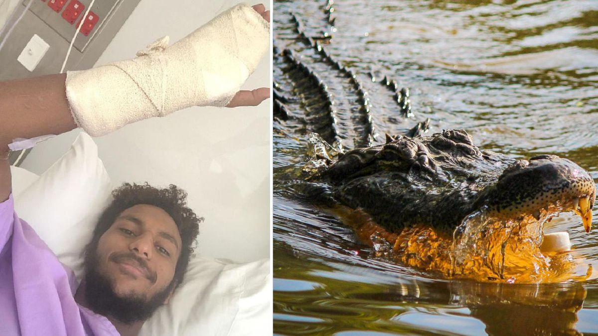 Un joven cuenta cómo se salvó del ataque de un cocodrilo: 