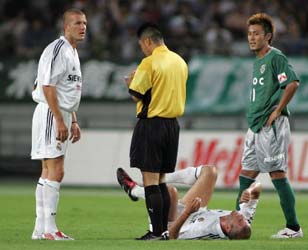 Zidane sufre artritis traumática en metatarso falángico