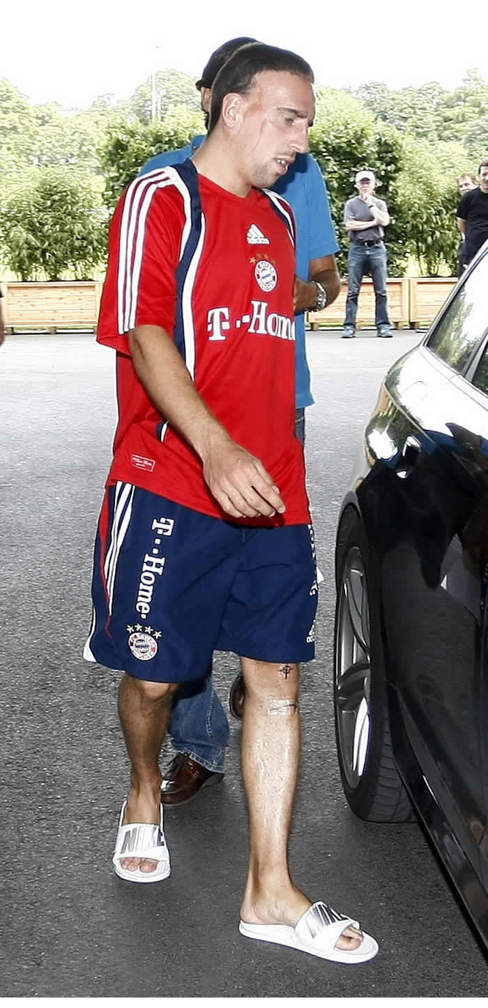 El Madrid, preocupado por las lesiones de Ribéry