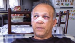 Un jugador rompe la nariz de su técnico a patadas en Bolívia