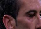 Suárez leaves his mark on Godín's face