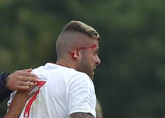 Menez, operado tras perder parte de la oreja en un juego