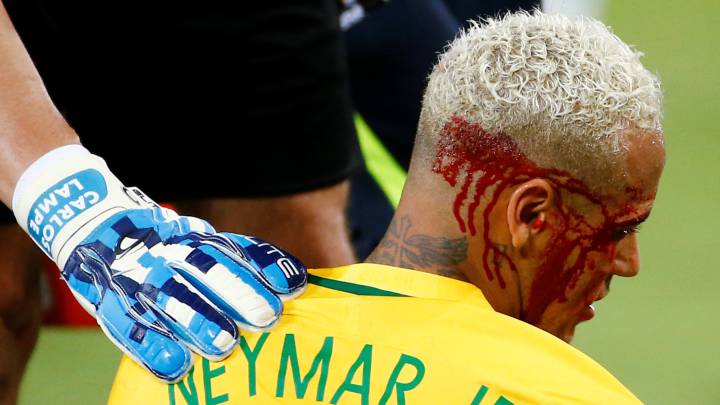 Así acabó Neymar tras el duro codazo del boliviano Duk