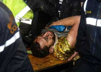 Helio Neto preguntó cómo había quedado la final tras haber despertado del coma