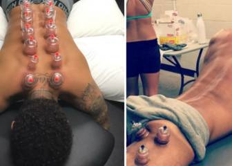 Neymar se recupera usando el método de Michael Phelps