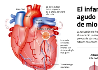 Gráfico: el tratamiento médico al que ha sido sometido Casillas