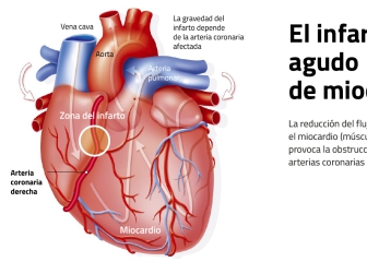 Gráfico: el tratamiento médico al que ha sido sometido Casillas