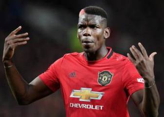 Pogba's mysterious injury