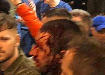 Aficionados del Wolverhampton en Barcelona: alerta por el coronavirus, cargas y reventa