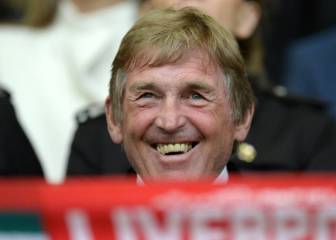 Kenny Dalglish recibe el alta tras dar positivo en coronavirus