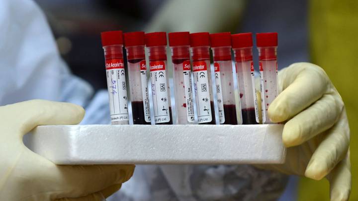 Test preventivos: los mdicos del ftbol piden una aclaracin