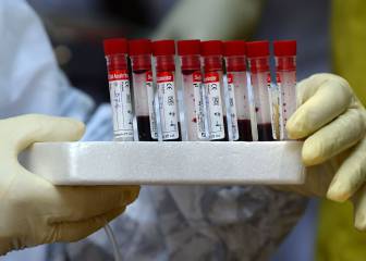 Test preventivos: los médicos del fútbol piden una aclaración