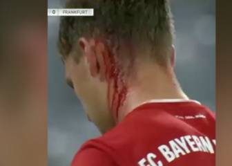 El terrible pisotón que recibió Kimmich: ¿Hay intención?
