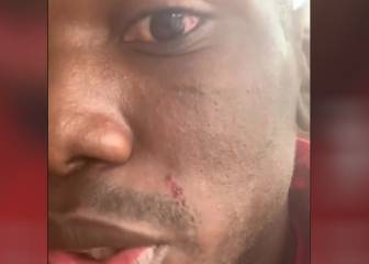 Pogba muestra los riesgos de entrenar con 