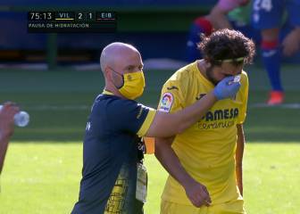 Patada voladora: Asenjo le rompe la nariz a Albiol