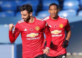 El único defecto de Bruno