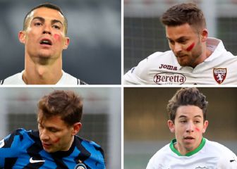 ¿Por qué se pintan la cara de rojo los jugadores en Italia?