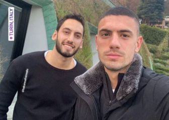 Calhanoglu y un viaje que tensa más la cuerda con el Milán