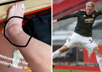 Van de Beek 'responde' a quienes le acusaron de fingir