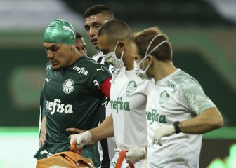 Se permitirá un cambio extra en caso de conmoción cerebral