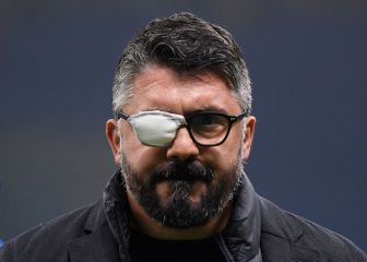¿Por qué Gattuso utiliza un parche en el ojo?